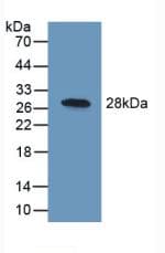 UCHL1 / PGP9.5 Antibody (aa2-223)