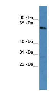 KRT3 / CK3 / Cytokeratin 3 Antibody (C-Terminus)