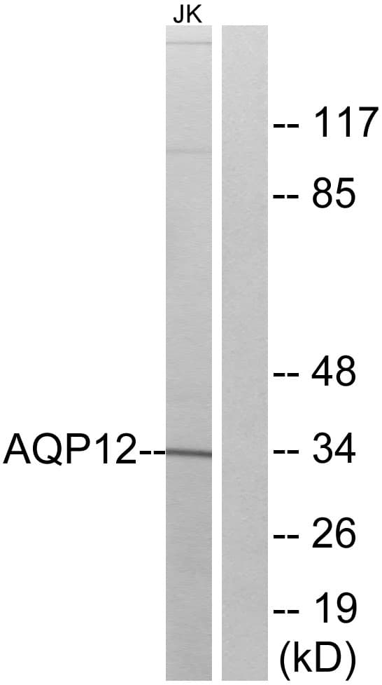 Polyclonal Rabbit anti-Human AQP12A / Aquaporin 12A Antibody (aa231-280, WB)