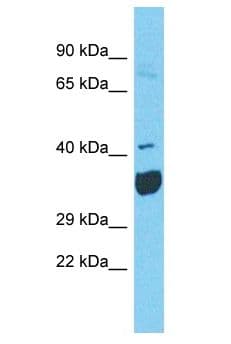 NEU2 / Sialidase 2 Antibody (aa119-168)