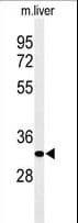 AIG1 Antibody (aa53-81)