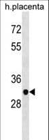 ZNF783 Antibody (aa1-30)