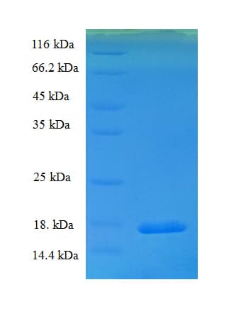 Rat MIRP1 / KCNE2 Protein (Recombinant His)