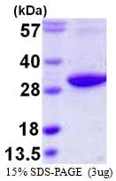 Human RAB3D Protein (Recombinant His)