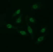 PathPlus™ CD163 Antibody (clone 1B4)