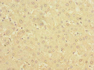 Polyclonal Rabbit anti-Human BDH2 Antibody (IHC)