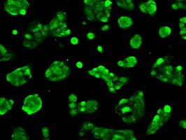 Monoclonal Mouse anti-Human BIRC7 / Livin Antibody (clone OTI1B10, IF, WB)