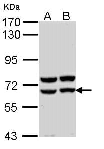 Polyclonal Rabbit anti-Human AMY2A / Pancreatic Amylase Antibody (aa156-430, IHC, WB)