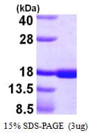 Human CD40L Protein (Recombinant His)