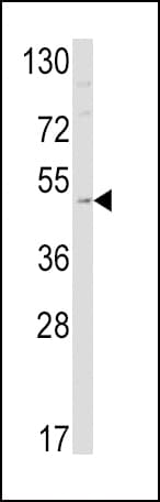 IHC-plus™ Polyclonal Rabbit anti-Human EDNRB / Endothelin B Receptor Antibody (aa409-439, IHC, IF, WB)
