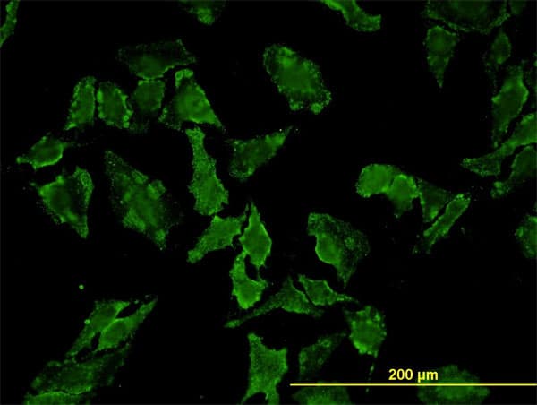 Monoclonal Mouse anti-Human HFE Antibody (clone 1G12, IF, WB)