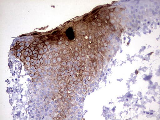 Monoclonal Mouse anti-Human S100A9 / MRP14 Antibody (clone UMAB173, Carrier-free, IHC, IF, WB)