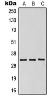 KIR2DS5 Antibody (Internal)