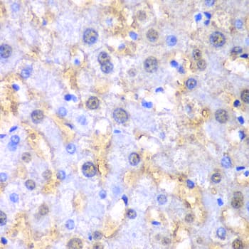 Polyclonal Rabbit anti-Human FAH Antibody (IHC, IF, WB)