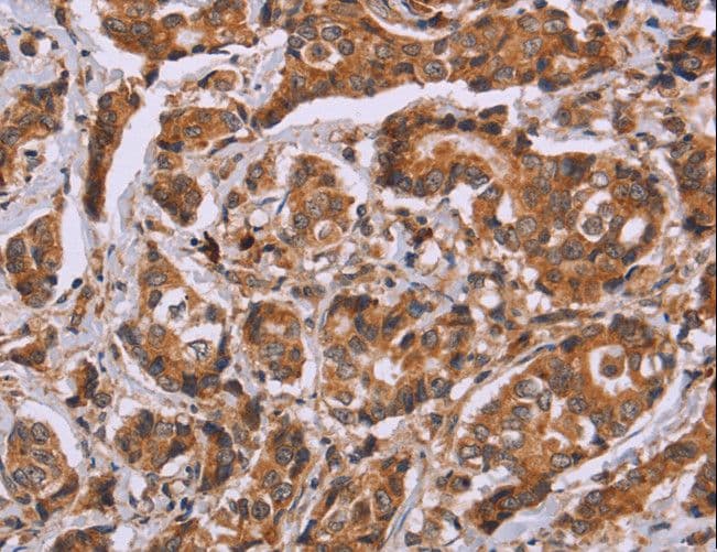 Polyclonal Rabbit anti-Human CALCA Antibody (IHC)
