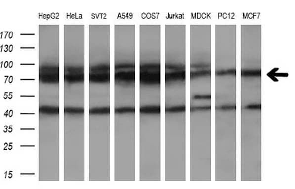 HSPA8 / HSC70 Antibody (clone OTI1H3)