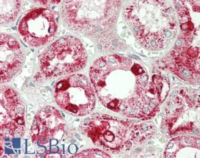 ANXA4 / Annexin IV Antibody (aa165-260)