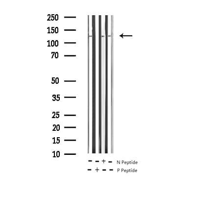 CASR/Calcium Sensing Receptor Antibody (phospho-Thr888)