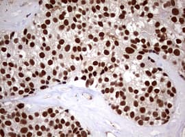 USP44 Antibody (aa420-712, clone OTI1D1)
