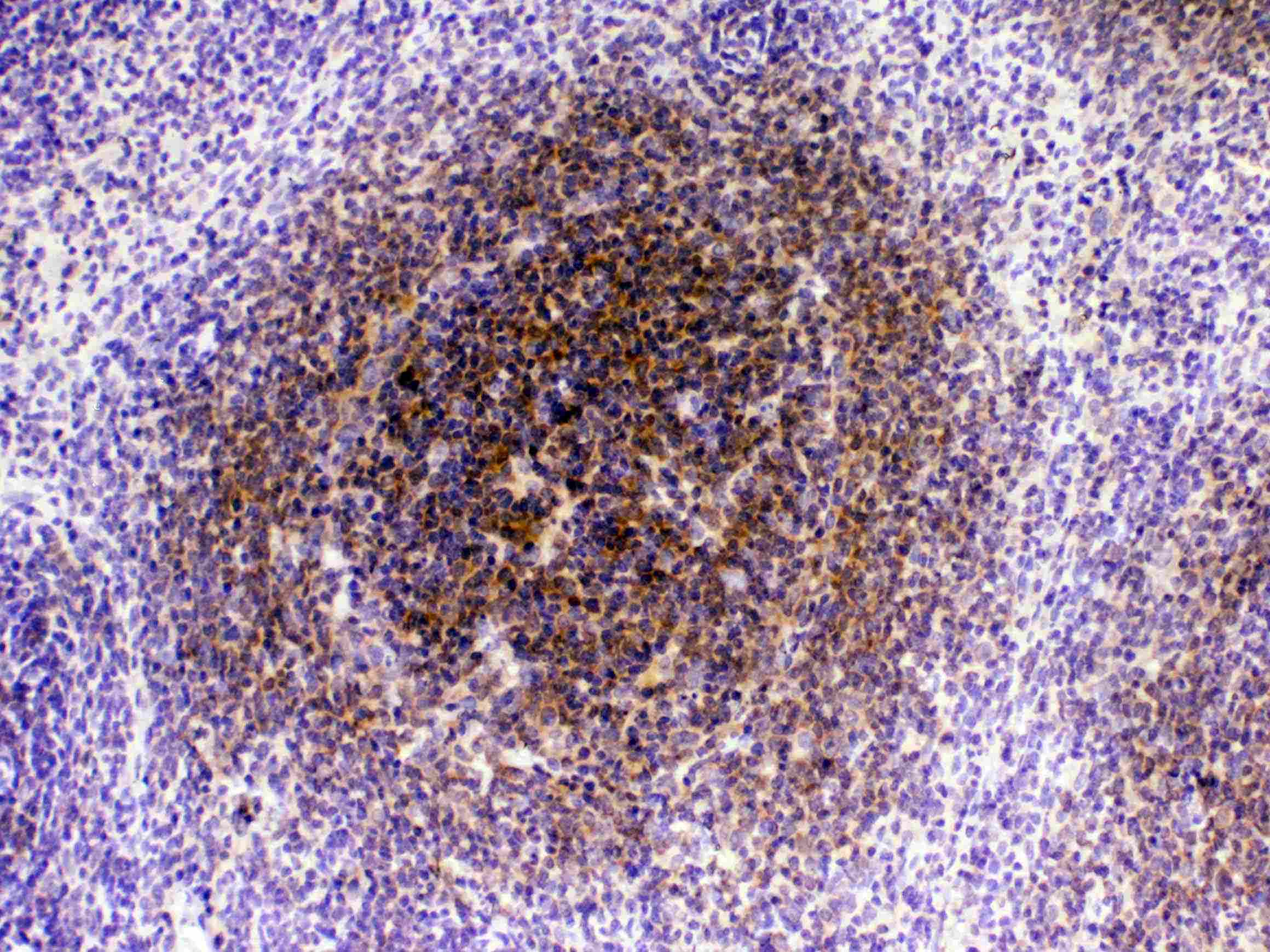 CTLA4 / CD152 Antibody (aa36-161)