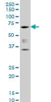 IHC-plus™ CBFA1 / RUNX2 Antibody (clone 3F5)