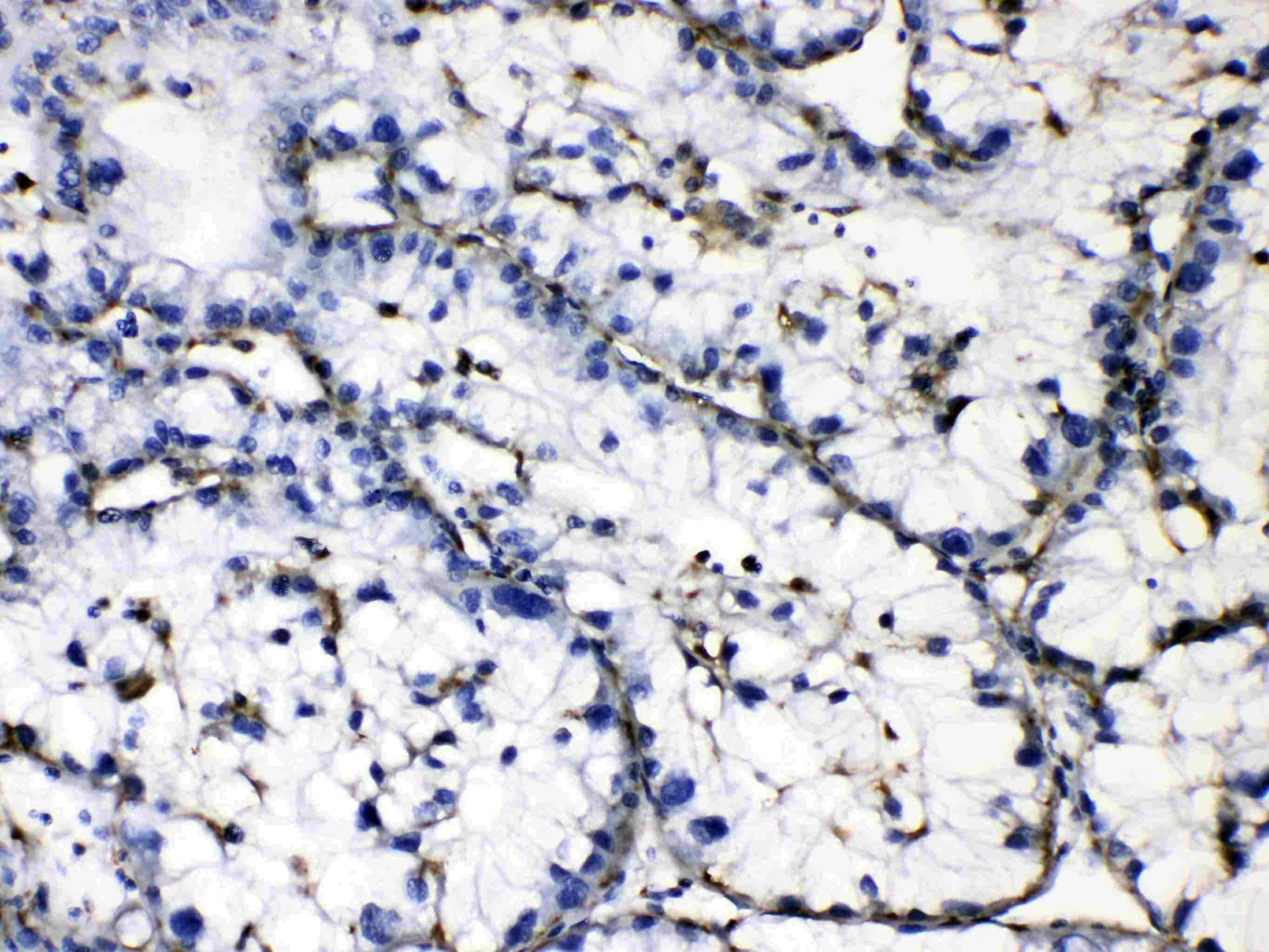 GAA / Alpha-Glucosidase, Acid Antibody