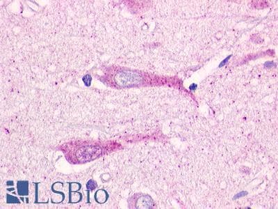 PathPlus™ GPR19 Antibody (Cytoplasmic Domain)