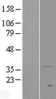 PAQR7 / mSR Protein (Over-Expression Lysate Myc-DDK (Flag))