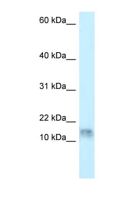 DNAL1 Antibody (N-Terminus)