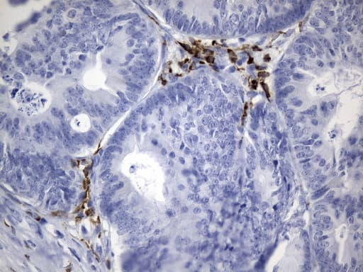CTLA4 / CD152 Antibody (clone UMAB249)