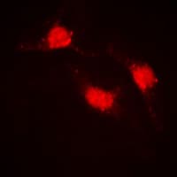 CTNNB1 / Beta Catenin Antibody (C-Terminus)
