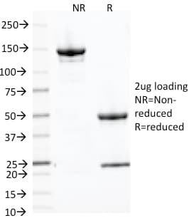 PLAP / Alkaline Phosphatase Antibody (clone ALPP/2889R)