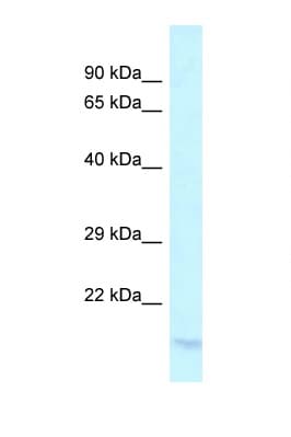 LY96 / MD2 / MD-2 Antibody (aa86-135)