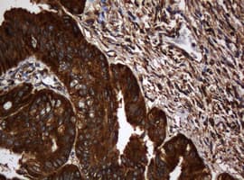 PAI-RBP1 / SERBP1 Antibody (clone OTI2E11)