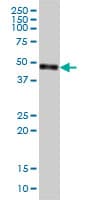 IHC-plus™ Monoclonal Mouse anti-Human CPVL Antibody (clone 2G5-1C1, IHC, IF, WB)