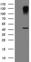 SERPINB1 Antibody (aa77-306, clone OTI2B4)