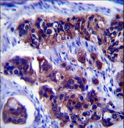 ZDHHC24 Antibody (aa214-241)