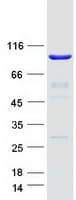 Human TTC27 Protein (Recombinant Myc-DDK (Flag))