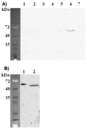Monoclonal Mouse anti-Mouse FTO Antibody (clone FT62-6, IHC, WB)
