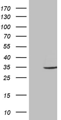 Monoclonal Mouse anti-Human ABCB1 / MDR1 / P Glycoprotein Antibody (clone OTI10C1, aa995-1280, WB)