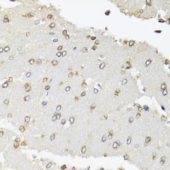POLR2B / RPB2 Antibody