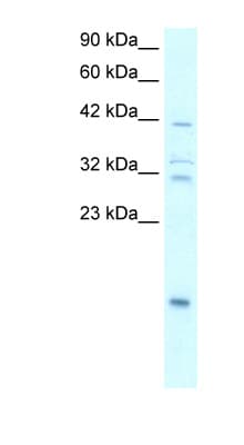 NFKBIA / IKB Alpha / IKBA Antibody (N-Terminus)