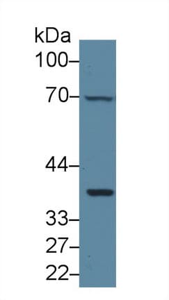IL6ST / CD130 / gp130 Antibody (aa606-756)