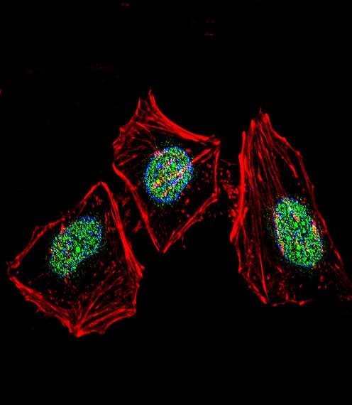 XRCC6 / Ku70 Antibody (aa521-548)