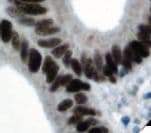 MSH6 Antibody (clone 44)