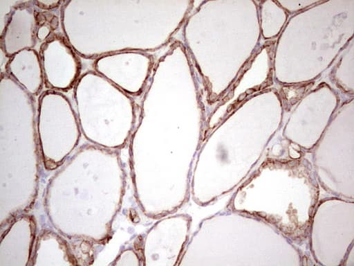 ABCB1 / MDR1 / P Glycoprotein Antibody (aa995-1280, clone OTI1A7)