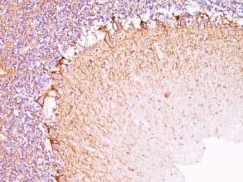 Neurofilament Antibody (clone NR-4)