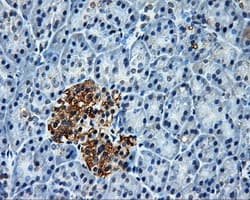 PLEK / Pleckstrin Antibody (clone OTI2D11)