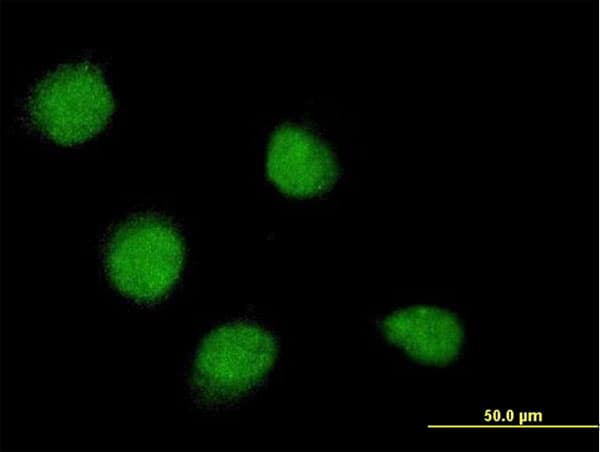 Monoclonal Mouse anti-Human SSX4 Antibody (clone 3E10, IF, WB)