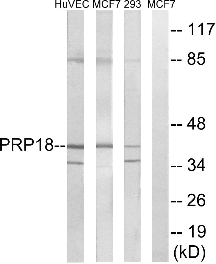 PRPF18 Antibody (aa182-231)